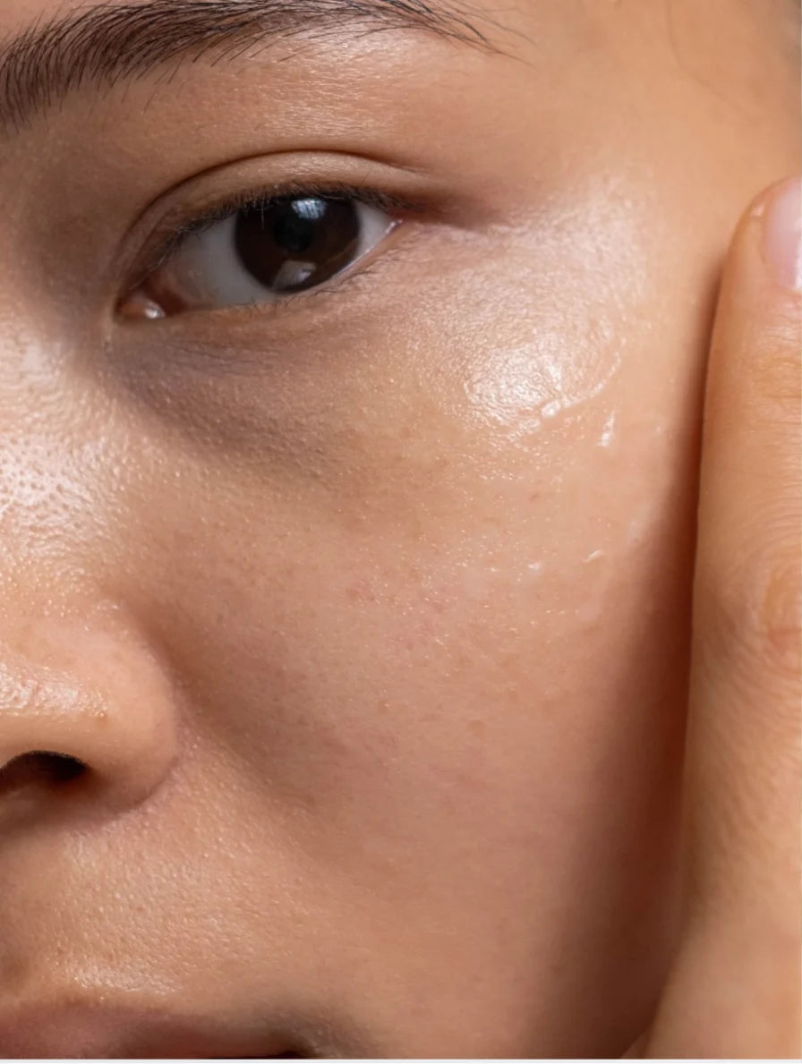 Niacinamide Treatment Gel